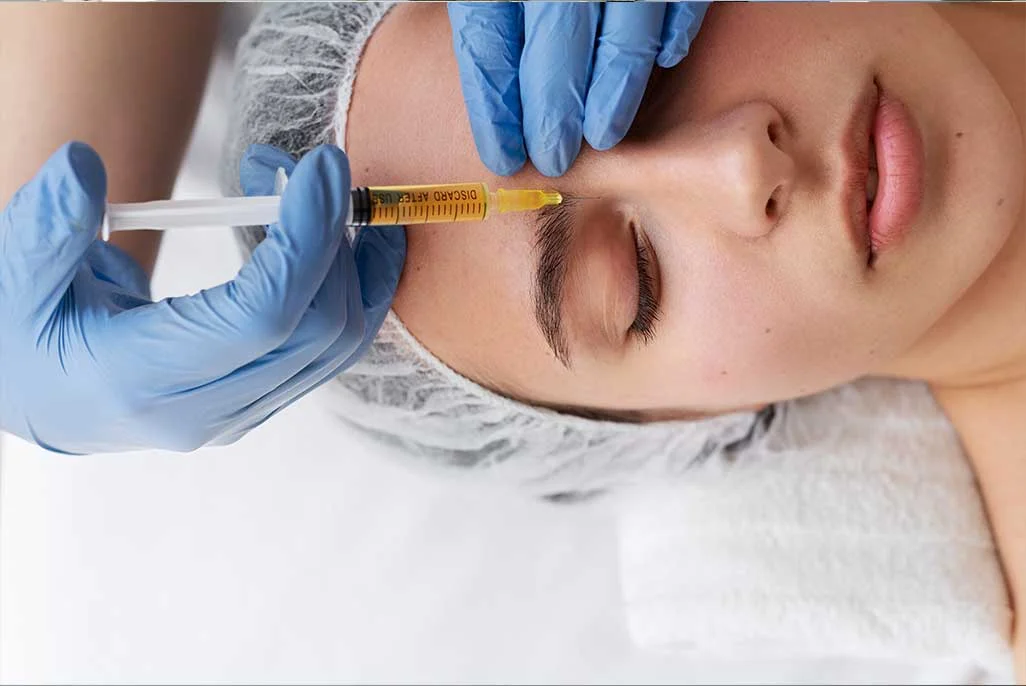 PRP Chemical Peeling